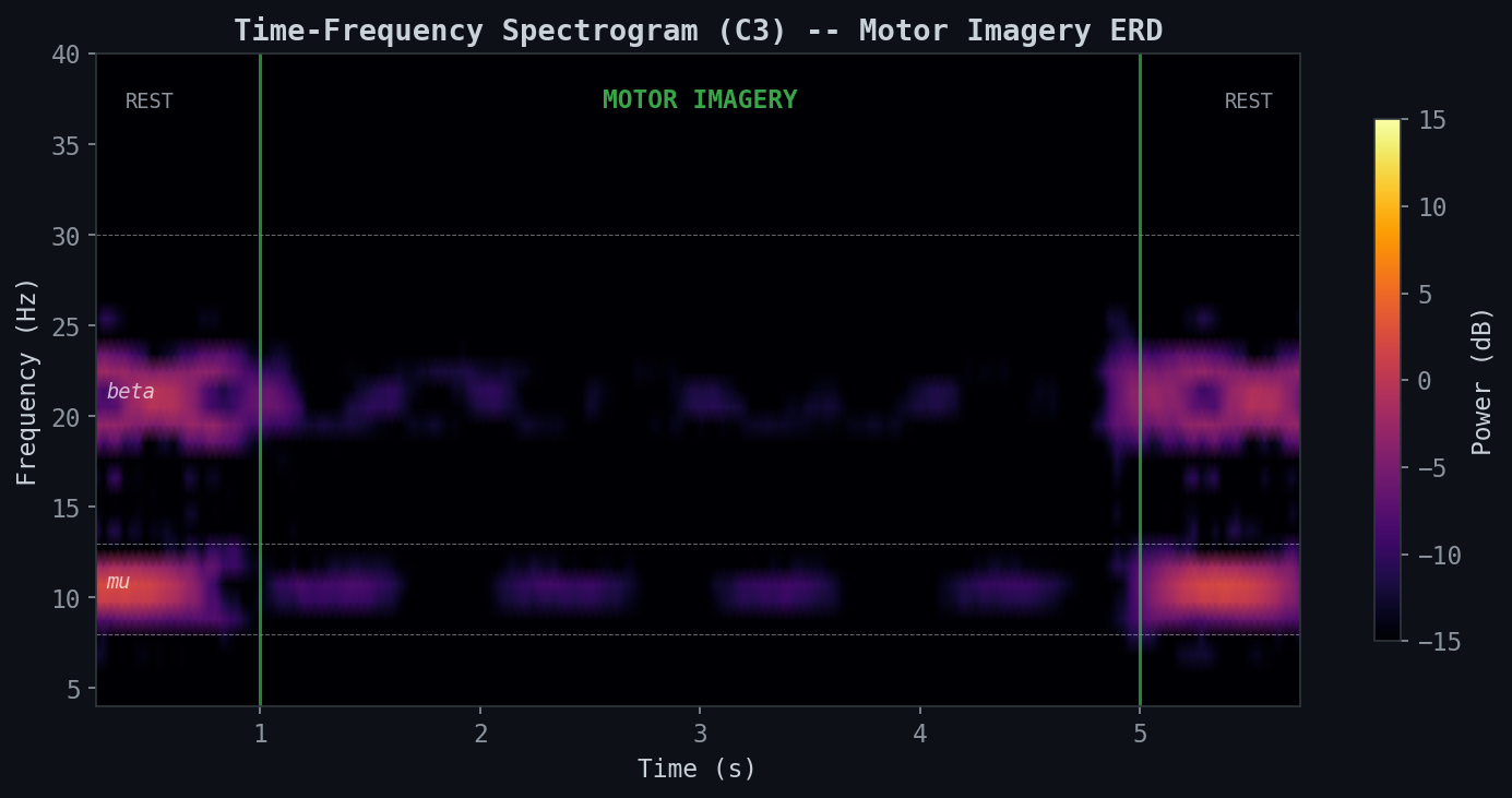 Time-Frequency Spectrogram